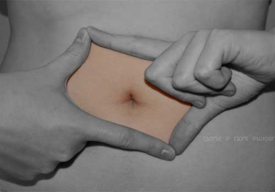 La cicatrice del cesareo: trattarla e curarla