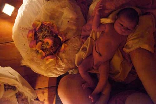 Lotus birth