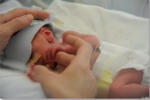 Neonato prematuro in Mangiagalli